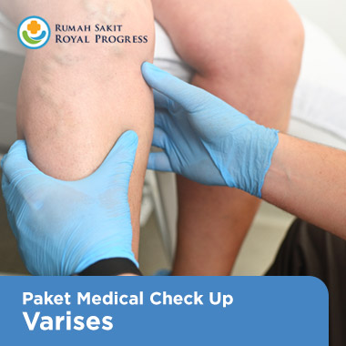 Varicose Veins Medical Check Up Package